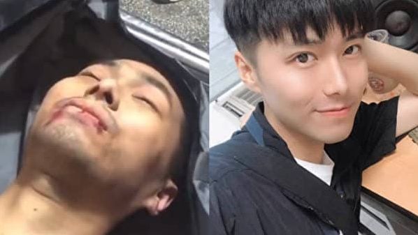 중국 쓰촨 라디오방송 진행자 팡쉰(좌)과 감옥에서 구타로 숨진 직후(우)
